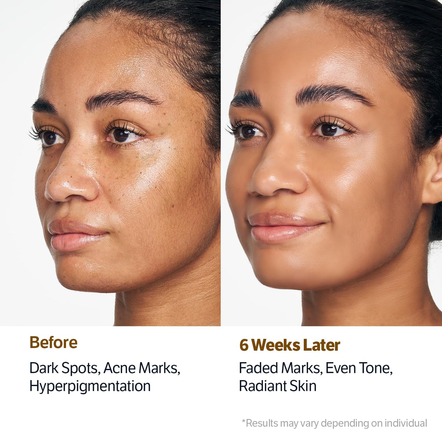 💗Last 3 Hours 50% OFF  ✨ BUY 2 GET 2 FREE🔥SONGBOON Editor Glass Skin Collagen Volufiline Cream-in-Serum | Firming Cream + Volufiline Serum Set  | Gentle, Nourishing &Comfort Korean Skincare Moisturizer for Firming & Hydrating